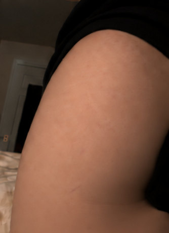 After 8 weeks